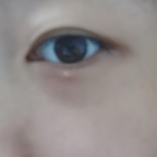 姐妹们我这是麦粒肿还是脂肪粒啊