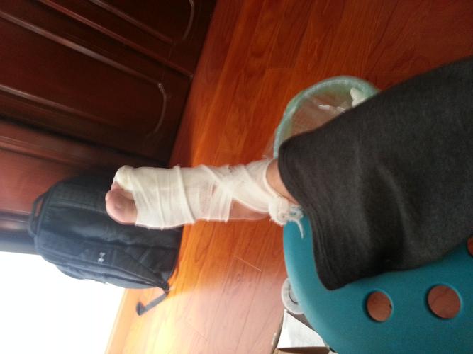 怎么办脚趾断了明天还要上补习班 我妈竟然让我穿连裤袜把石膏固定住