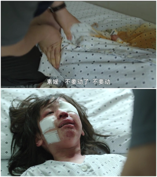 电影里,素媛的直肠到大肠的最顶端,多发性创伤与撕裂,大肠与小肠部分