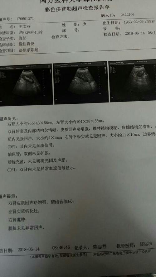 妈妈55岁,b超显示结果双肾皮质声略增强,右肾囊肿左肾
