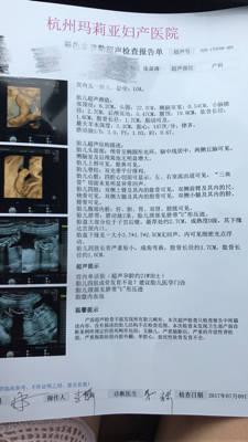 今天做四维,检查出来四肢短小,成角弯曲,医生是可能是