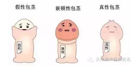 包皮与龟头之间可引起包皮发炎,小jj会出现红肿,痒痛甚至流脓的现象