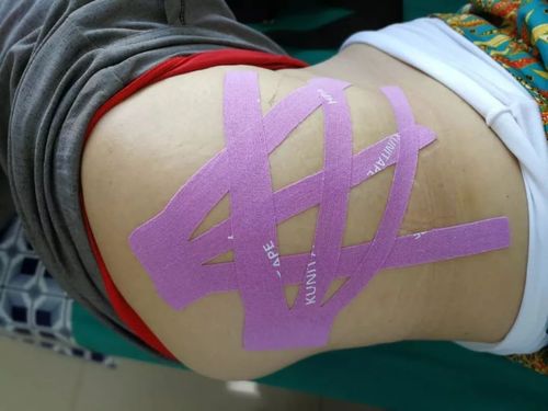 右侧髋关节疼痛