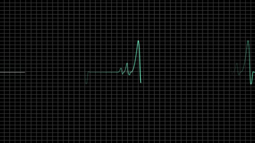 心电图跳到停止_1920x1080_高清视频素材下载(编号:)