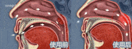 鼻腔"神药",一抹5秒通鼻,除涕止痒,清爽一