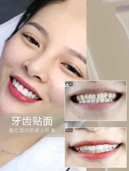 一口大白牙 笑起来才更自信90 三分相貌 七分微笑96_口腔_美妆_医