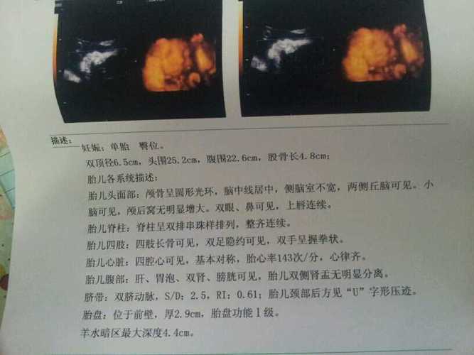 宝宝的四维彩超照像他爸爸
