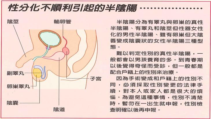 半阴阳分为有睾丸与卵巢的真性半阴阳,有睾丸和阴茎但性器女性化