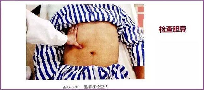 不剖开他肚子他们三个都会死不瞑目