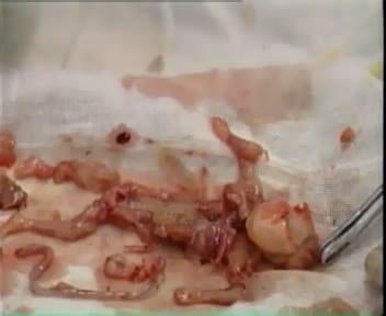 一封7个月大被引产胎儿的天堂来信