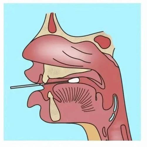 将拭子越过舌根,在被采集者两侧咽扁桃体稍微用力来回擦拭至少3次