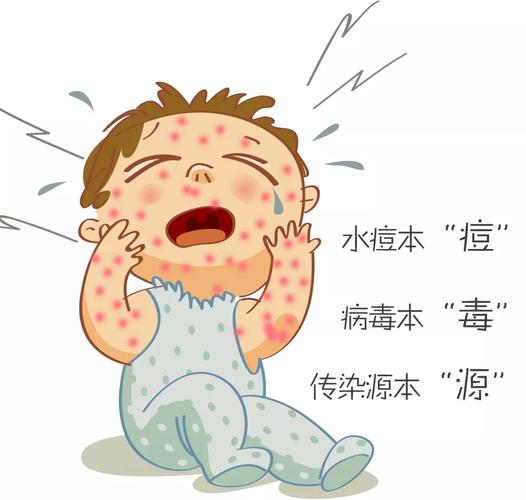 水痘进入高发期,这些"战痘"知识你不能不知