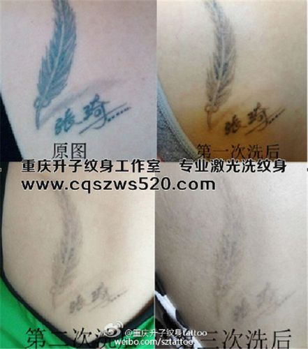 重庆洗纹身 重庆洗纹身价格 重庆洗纹身案例 便宜又好