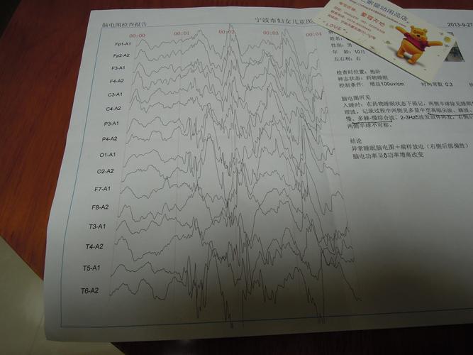 患儿是west病吗?(有头颅mri片及脑电图)