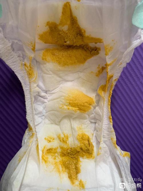 宝妈们帮忙看看奶粉宝宝这样的便便正常吗
