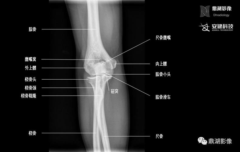 精致腕关节解剖   x线高清图谱 | 精致肘关节解剖   x线高清图谱