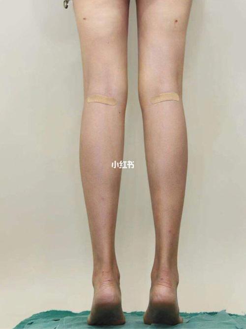 肌肉腿跟脂肪腿做完后效果图_肌肉腿_美腿_运动健身