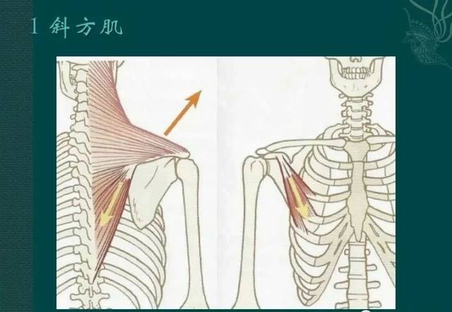 肩颈痛(斜方肌损伤)较全的诊疗思路
