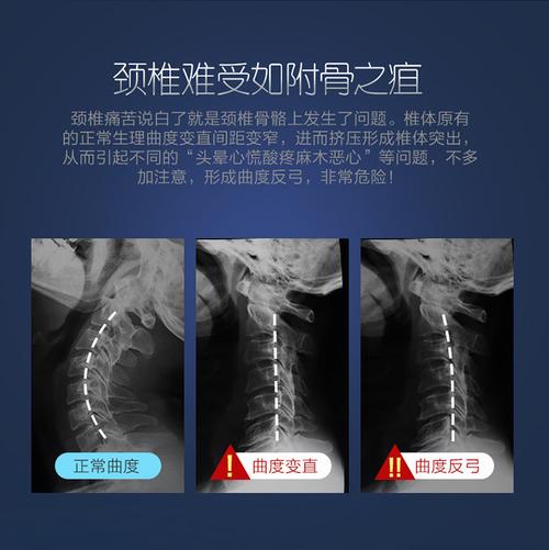 颈椎枕头修复颈椎反弓病人牵引理疗枕矫正成人劲椎曲度专用护颈枕
