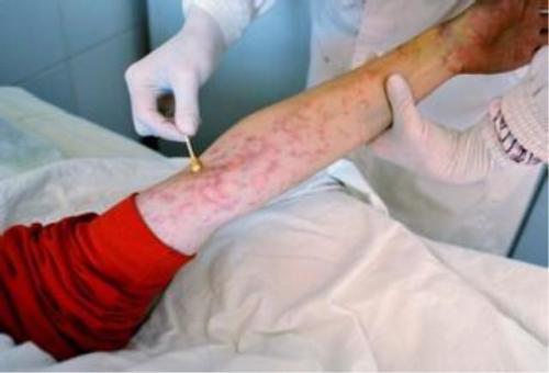 戴套嫖娼感染艾滋病的概率大吗?