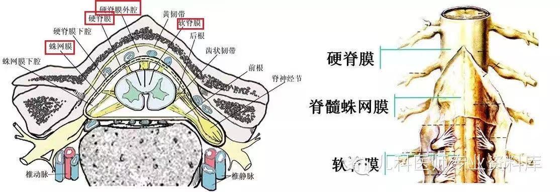 腰穿时针头斜坡方向和穿刺后头痛