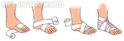 69 运动与医学:一个真正的医生ezer谈脚踝扭伤的处理  打绷带的方法