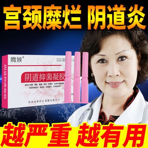 妇科炎症凝胶阴道炎私处瘙痒霉菌性烂糜宫颈糜烂重度用药治疗的药