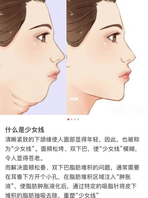 如何留住少女线_双下巴_下颌线_减龄_美妆_医美整形