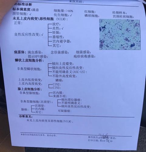 hpv52转阴啦,tct也正常了,好开心