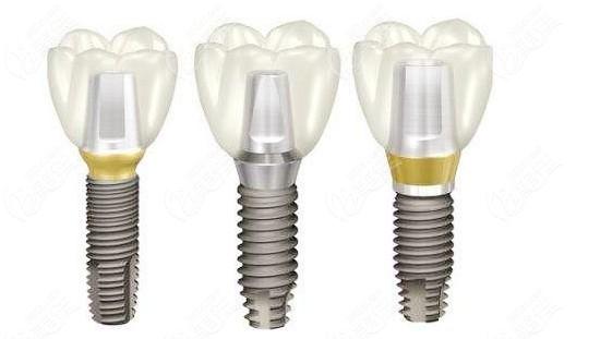 韩国种植体外观