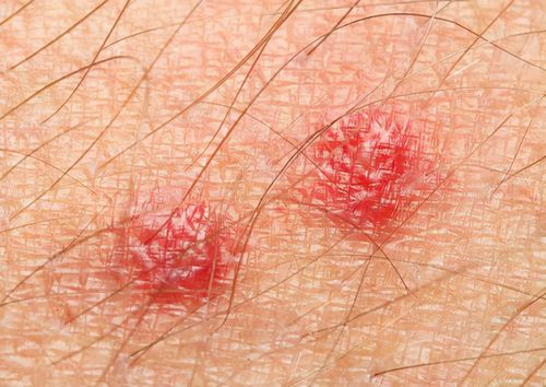 别慌,还可能是这两种情况_外阴