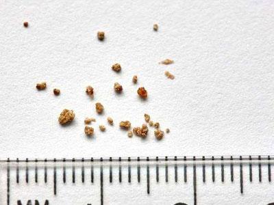 双肾结石吃什么中药