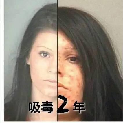 吸毒者面容的变化令人震惊,用以警示众人.