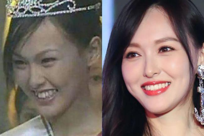 唐嫣早期的牙齿问题比较严重,上牙有轻微的龅,下牙牙列拥挤, 纠正