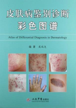 皮肤病鉴别诊断彩色图谱