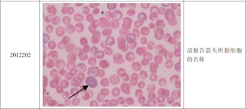 嗜多色性红细胞