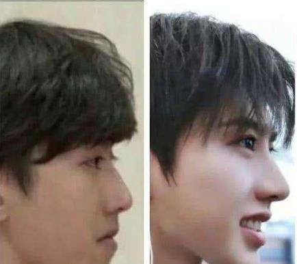 蔡徐坤整容前后对比照