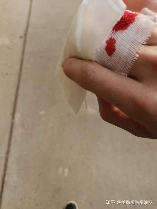 在没有保护的情况下用拳头砸玻璃会伤到手吗?