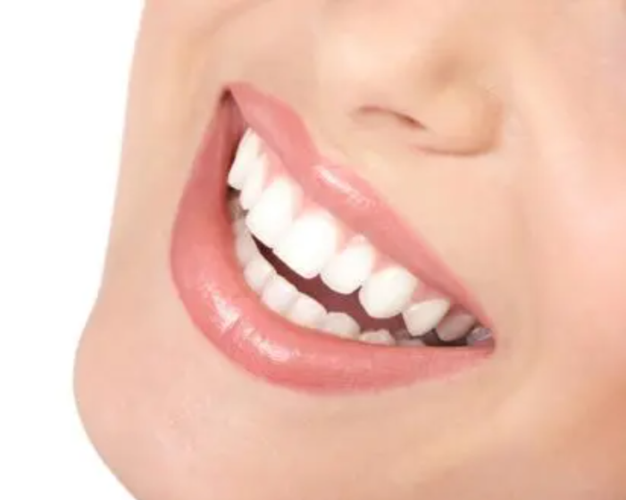 天天刷牙为什么牙齿还是微黄?