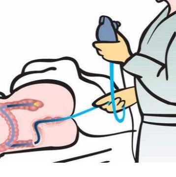 哪些人群不宜做肠镜检查