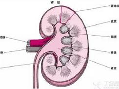多肾盏畸形是一少见的先天性异常,其主要肾盏和肾盂位于肾实质之外