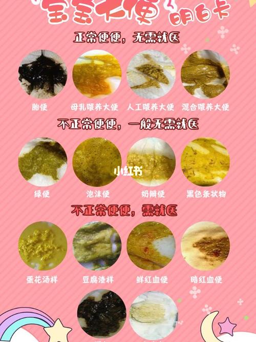 宝宝腹泻,拉肚子,病毒感染71附上大便健康卡._腹泻