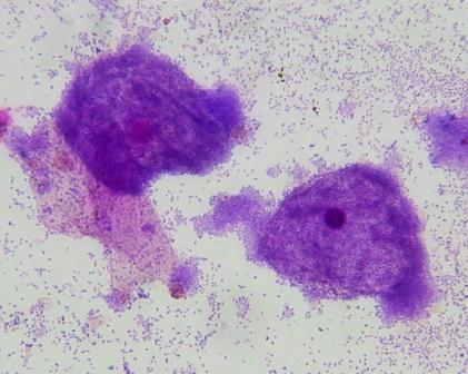  p>加德纳菌( gardneralla vaginalis, gv)是一类革兰染色阴性或阳性