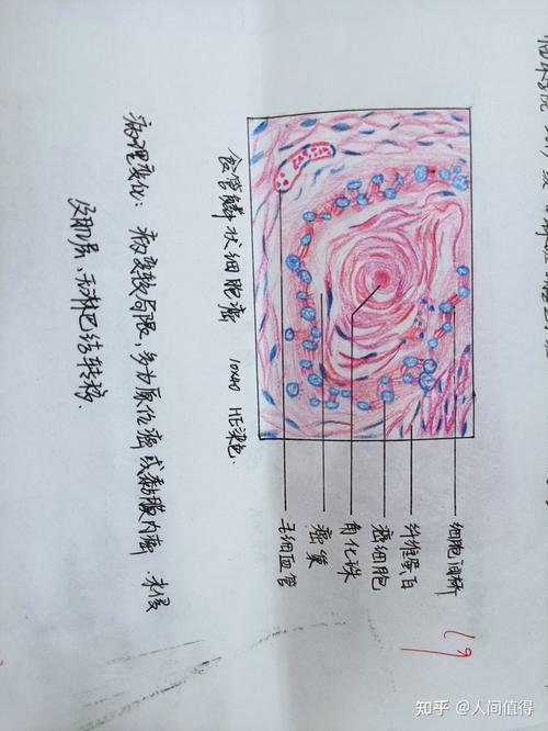 病理红蓝铅笔绘图