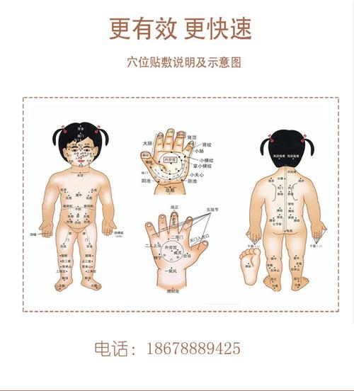 琼森/穴位贴敷治疗贴/消食贴/8贴装