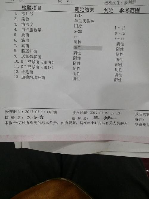 霉菌阴道炎(热带假丝酵母菌)怎么治疗