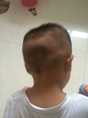 二岁半的小男孩后头不扁还能睡扁吗?