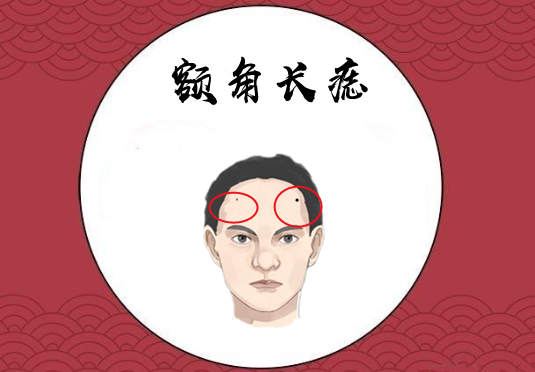 额角的位置在相学当中,又被称之为"迁移宫",若是在此处的位置长有恶痣
