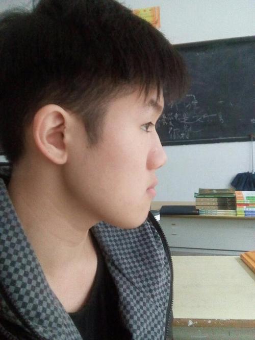 我是属于地包天的男生,因为地包天的我很自卑,请问下地包天在一般的镇