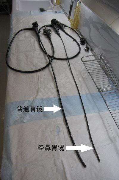 经鼻超细无痛胃镜